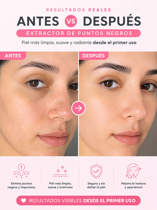 Antes y Después - Extractor de Puntos Negros
